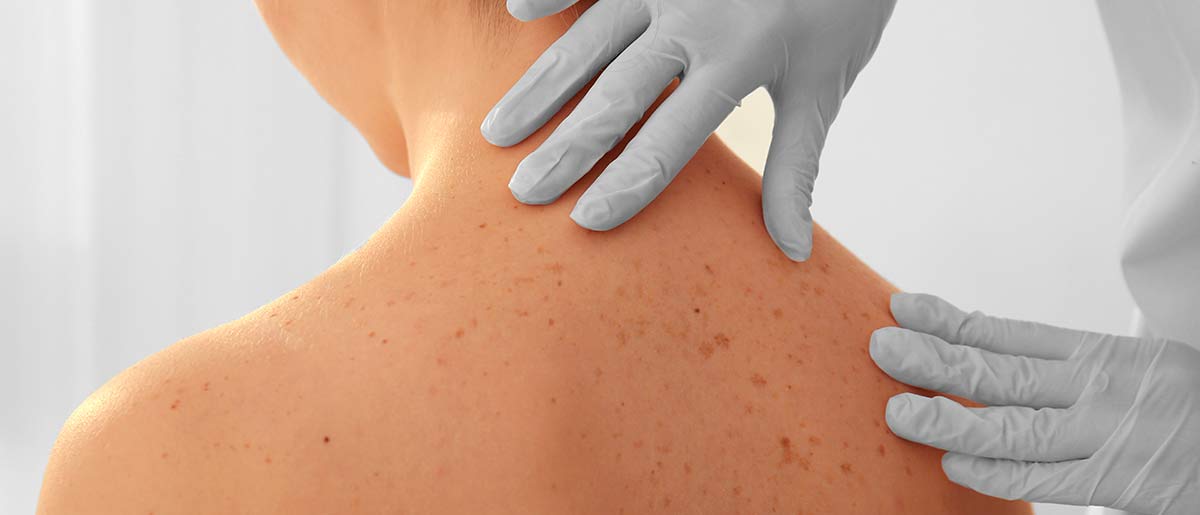 Dermatologia Jesolo