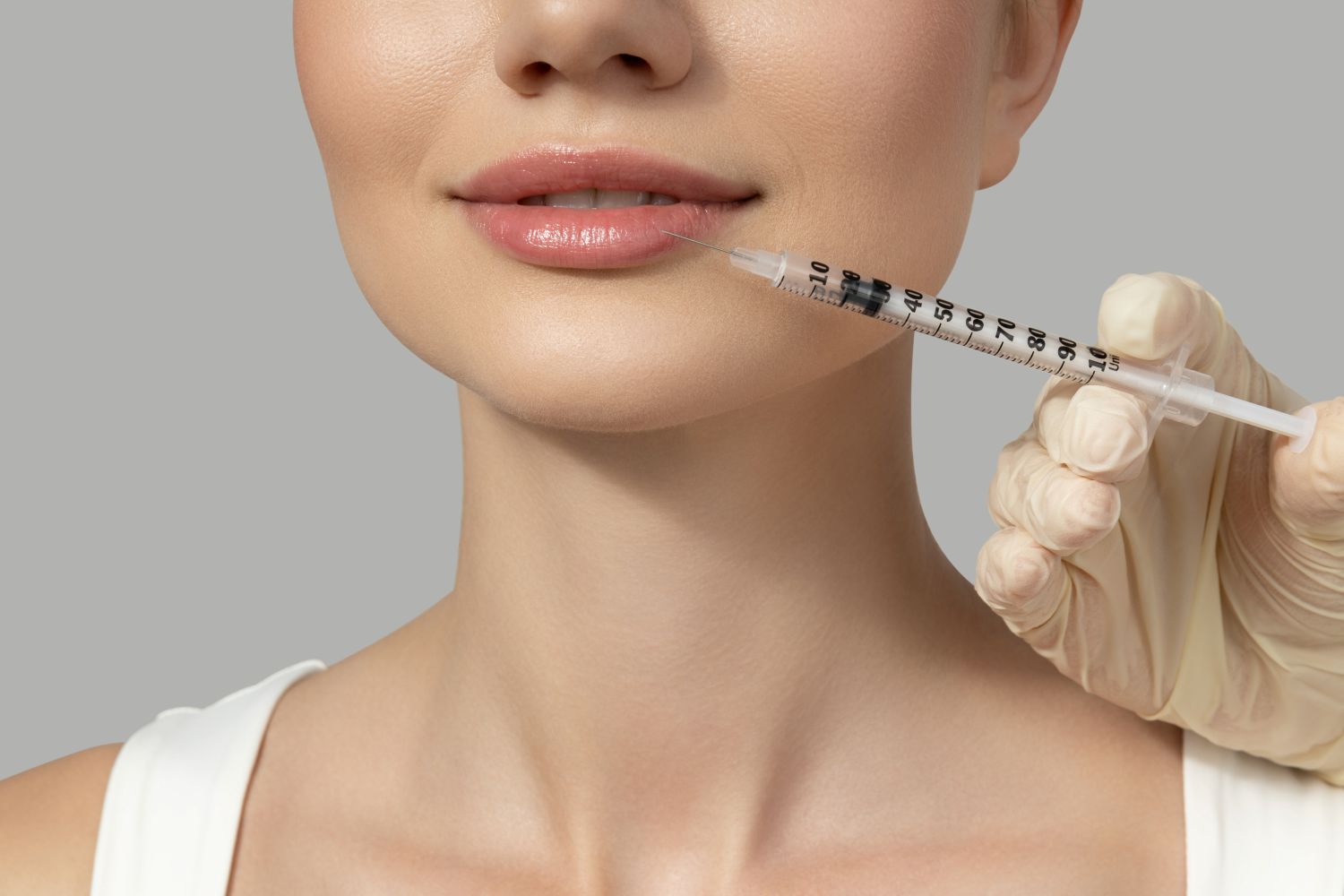 Trattamento Filler Jesolo: Vantaggi, Durata e Controindicazioni